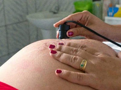 Teste para HTLV passa a ser indicado para gestantes durante pr-natal
